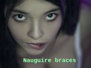 Nauguire_braces
